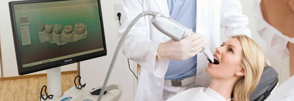 intral-oral-scanning
